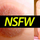 Image for article titled Woman Grows Full Size Nipple On Foot